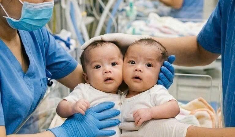 “Hai Đứa Trẻ Dính Liền Đầu – Hành Trình Kỳ Tích Lay Động Triệu Trái Tim Việt